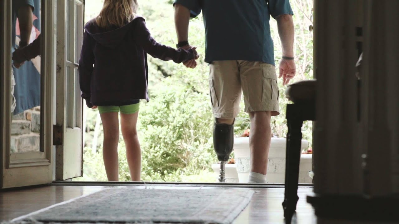 Keith's Amputee Story
