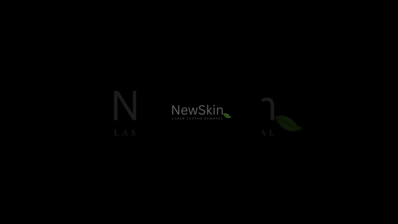 Tattoo Removal near me |  Easy, fast and nearly painless  |  Best San Antonio TX  Results in Texas