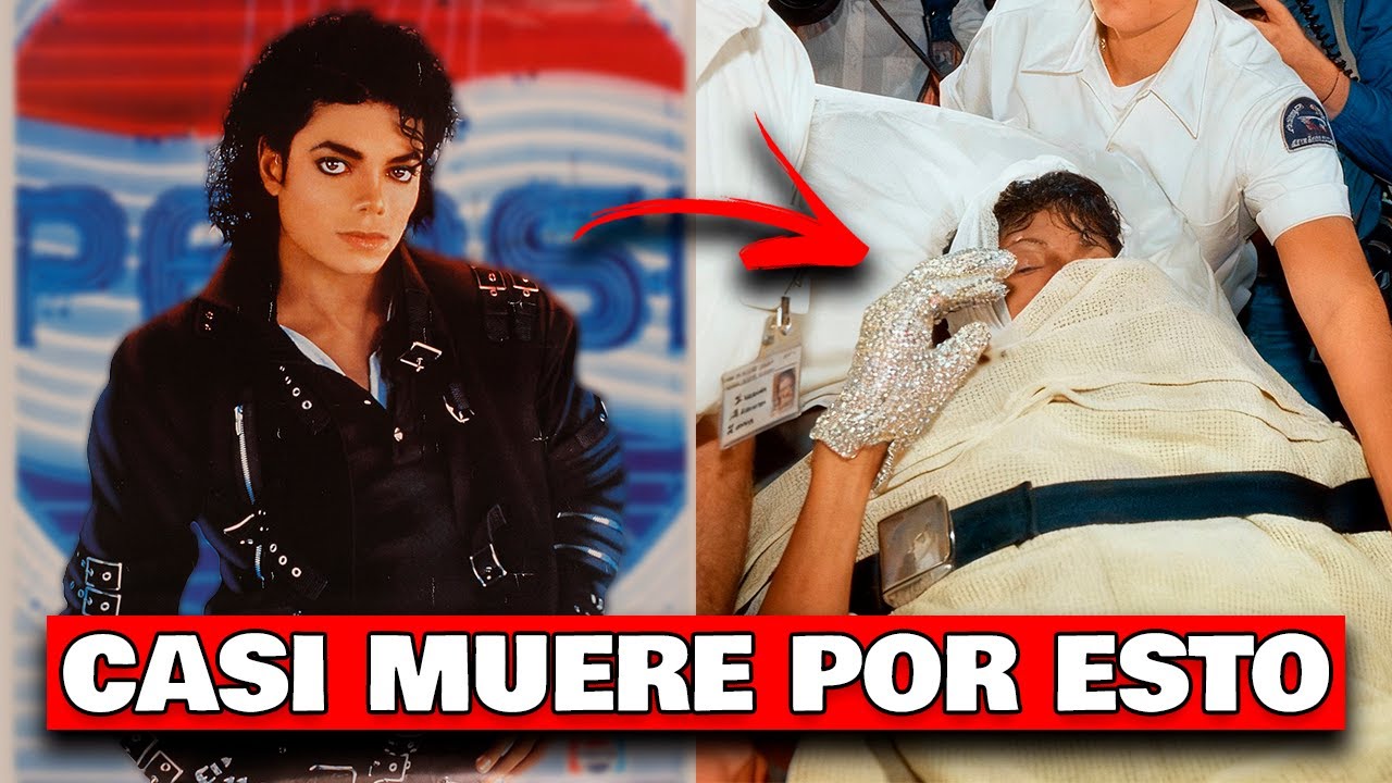 El día que MICHAEL JACKSON se prendió fuego por culpa de PEPSI