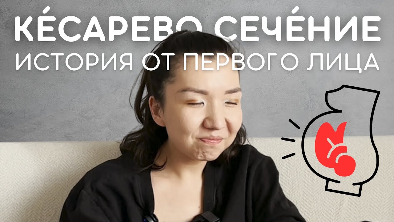 МОИ РОДЫ. ПЛАНОВОЕ КЕСАРЕВО СЕЧЕНИЕ. полный рассказ.