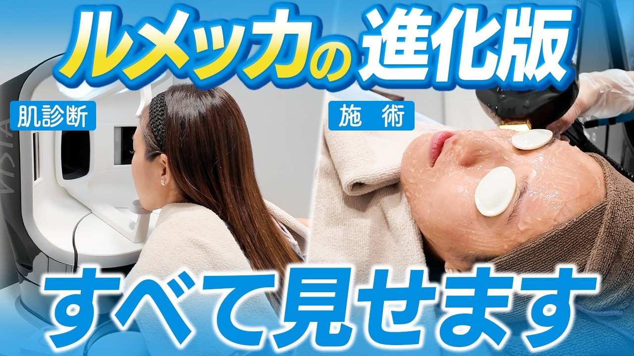 シミ・そばかす・赤ら顔をすべて治す最新 "光治療のルメッカピーク" のすべて