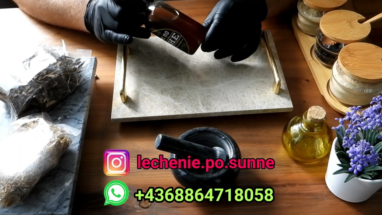 Кровоточат десны, неприятный запах изо рта, пародонтит. .