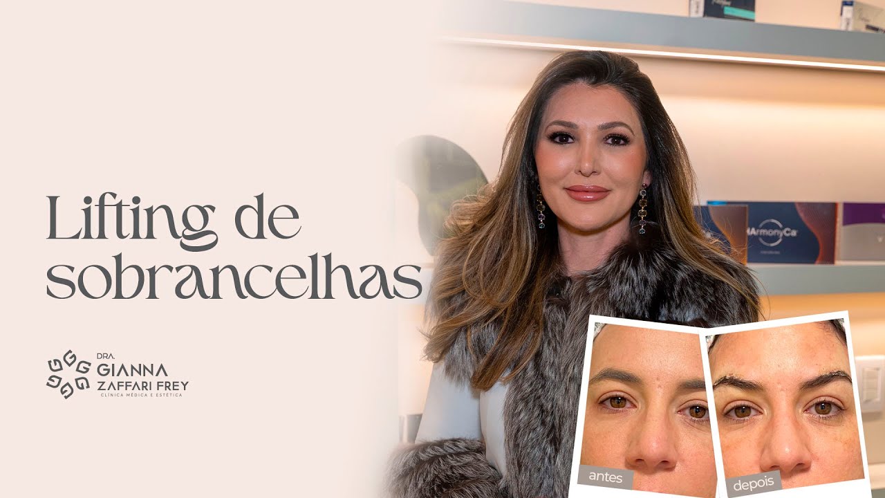 Lifting de sobrancelhas