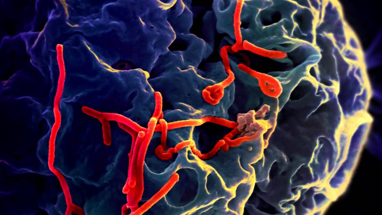 What makes Ebola virus so deadly?