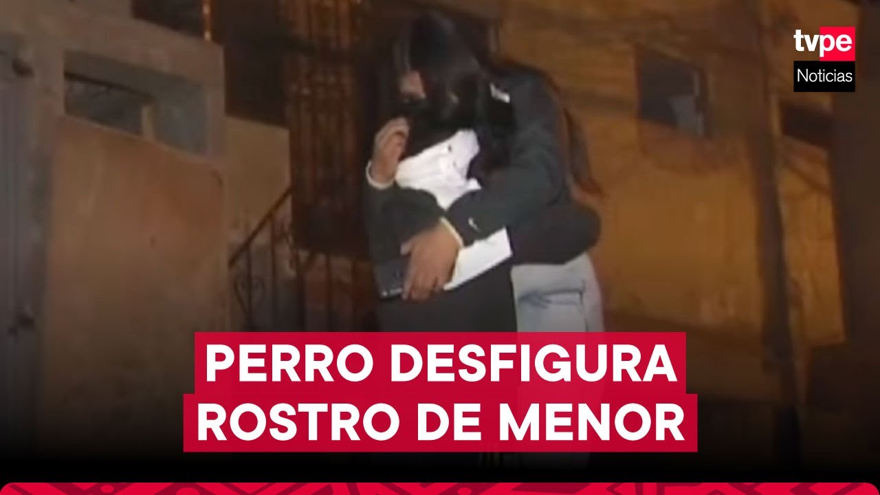 Niño de 7 años fue atacado en el rostro por perro de un familiar en Villa El Salvador