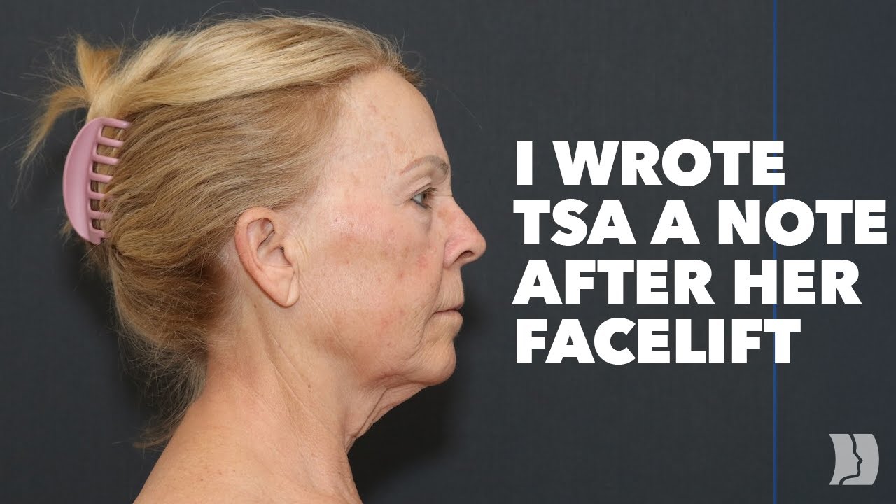 She Was Worried TSA Wouldn't Accept Her ID After Facelift