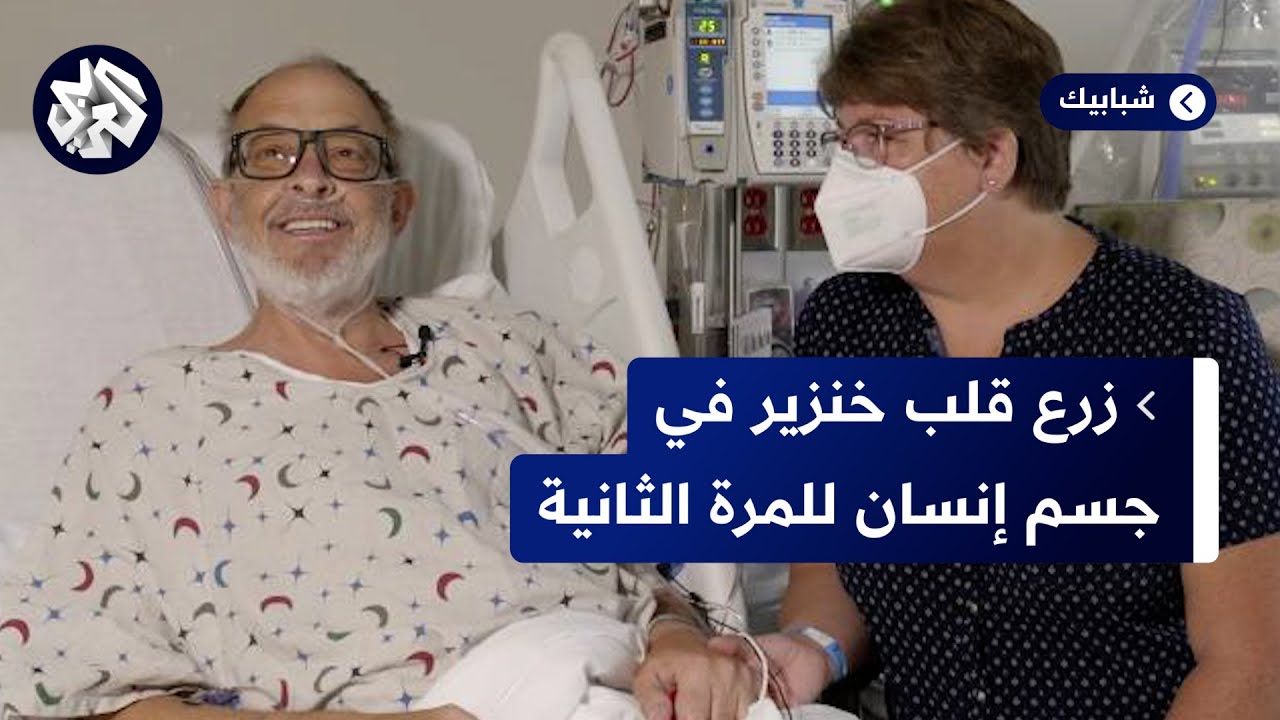 بعد وفاة المريض الأول.. زرع قلب خنزير معدل وراثيا في مريض ثان