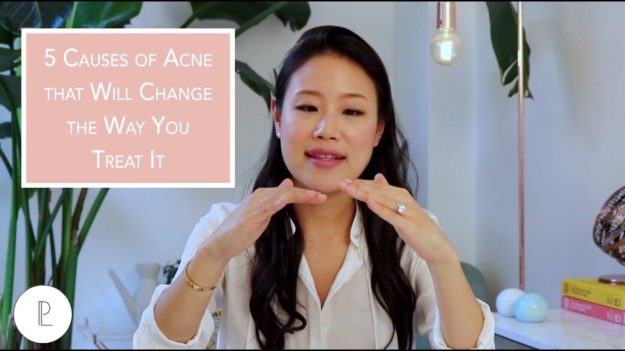 5 Causes of Acne that Will Change the Way You Treat It | Peach & Lily