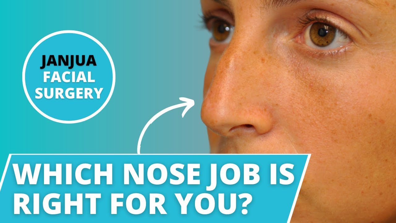 WHAT NOSE JOB SHOULD YOU GET? COMMON TYPES OF NOSE JOBS - DR. TANVEER JANJUA - NEW JERSEY