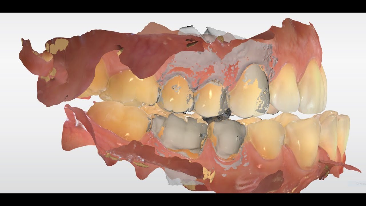 Taking Multiple Bites for Appliances