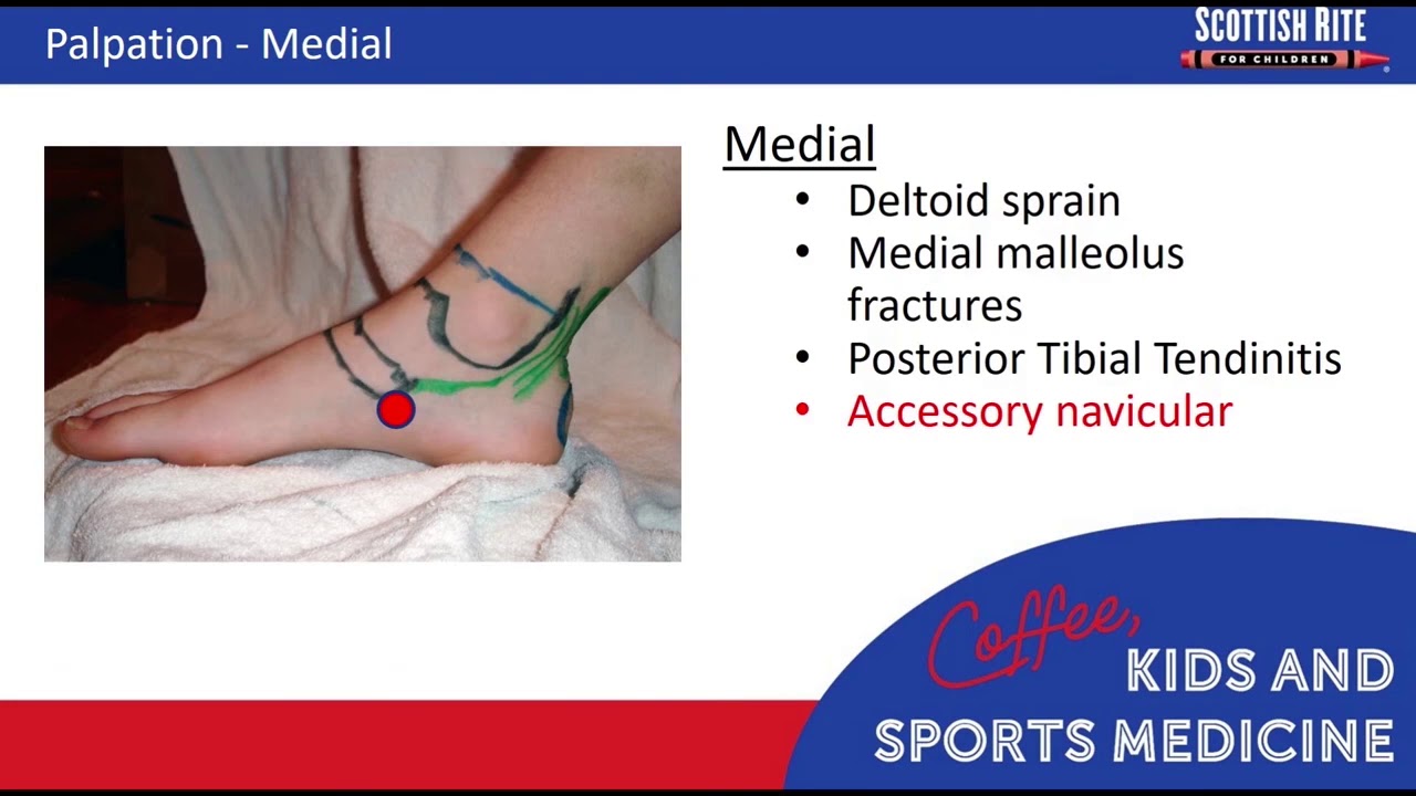 Coffee, Kids and Sports Medicine – Adolescent and Pediatric Ankle Exam