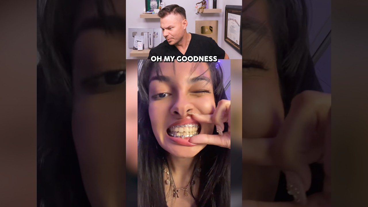 They Put Braces On Her GUMS?! 😮🦷