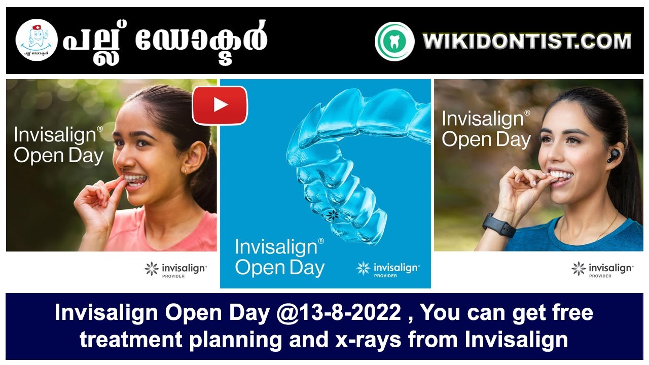 Invisalign Open Day @13-8-2022 , You can get free treatment planning and x-rays from Invisalign