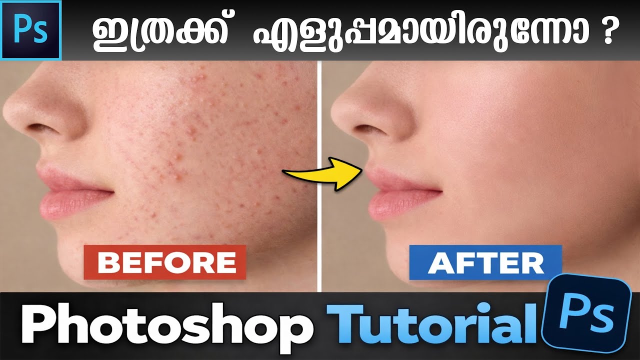 Photoshop Skin Retouching Tutorial Malayalam | Pro Editing Trick | Pixel Malayali