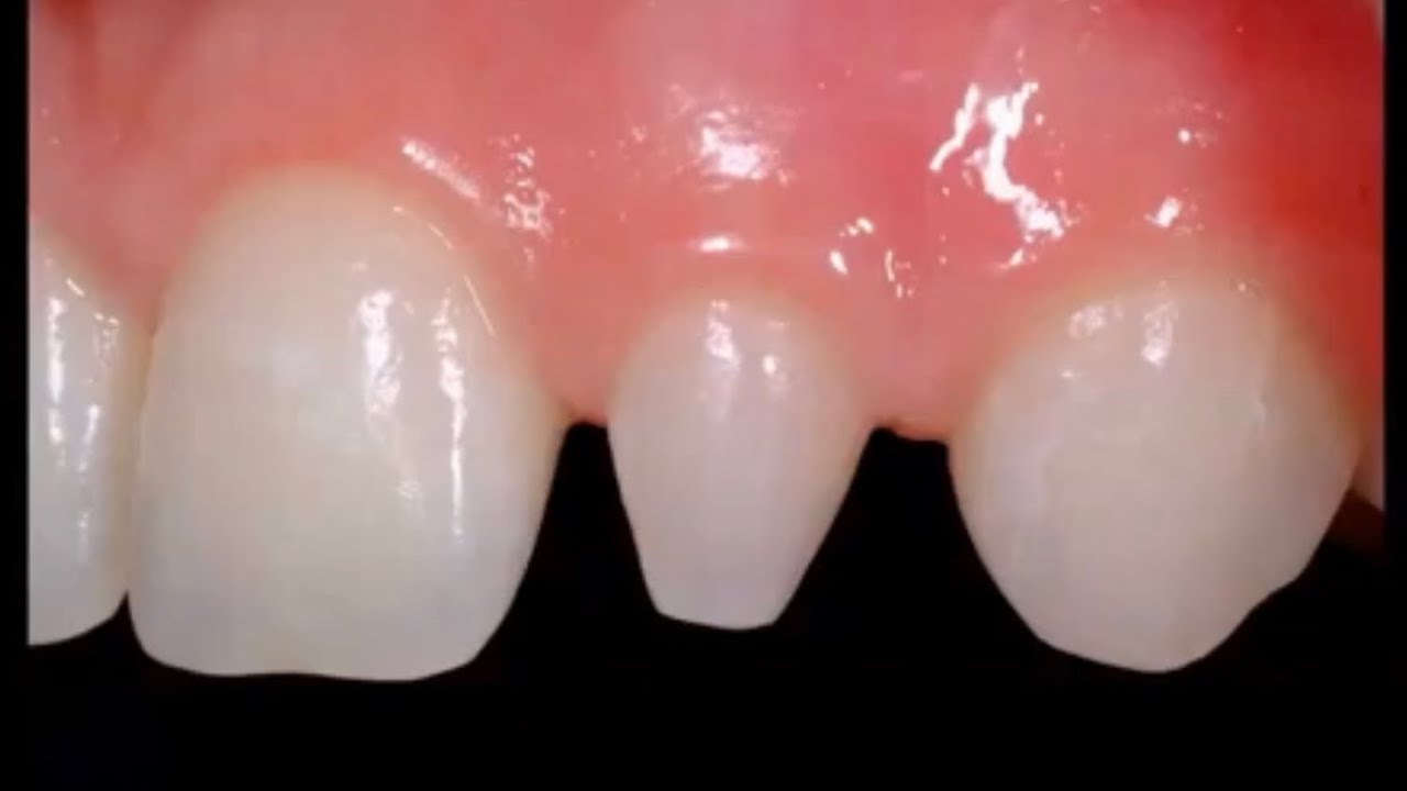 Basics - bioclear by dr david clark