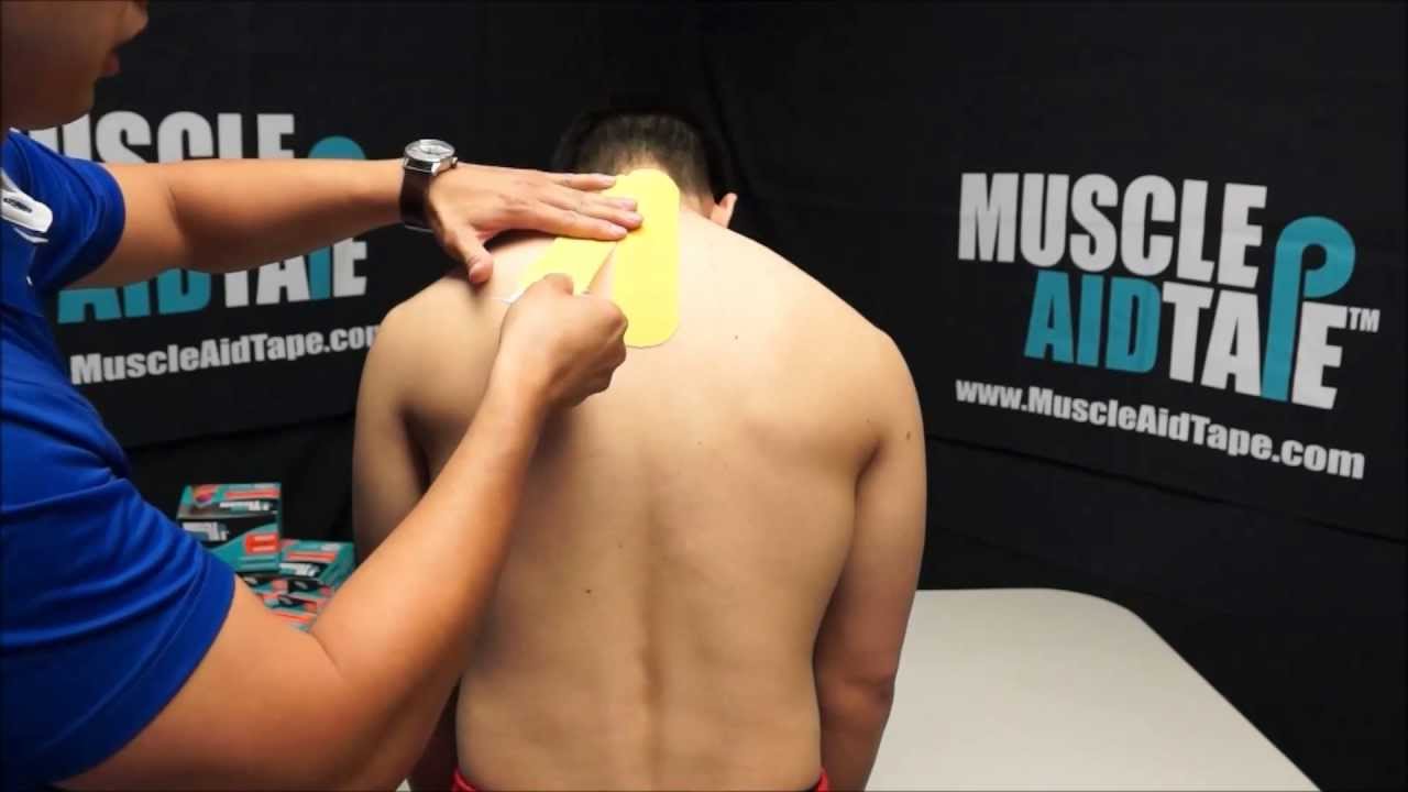 MuscleAidTape: Cervical Disc Pain