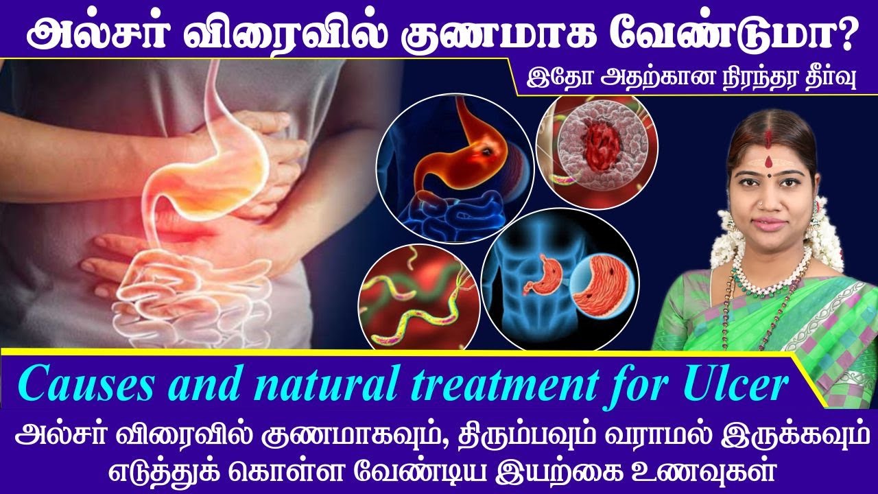 அல்சர் விரைவில் குணமாக & திரும்பவும் வராமல் இருக்க இயற்கை உணவுகள் | Natural treatment for Ulcer