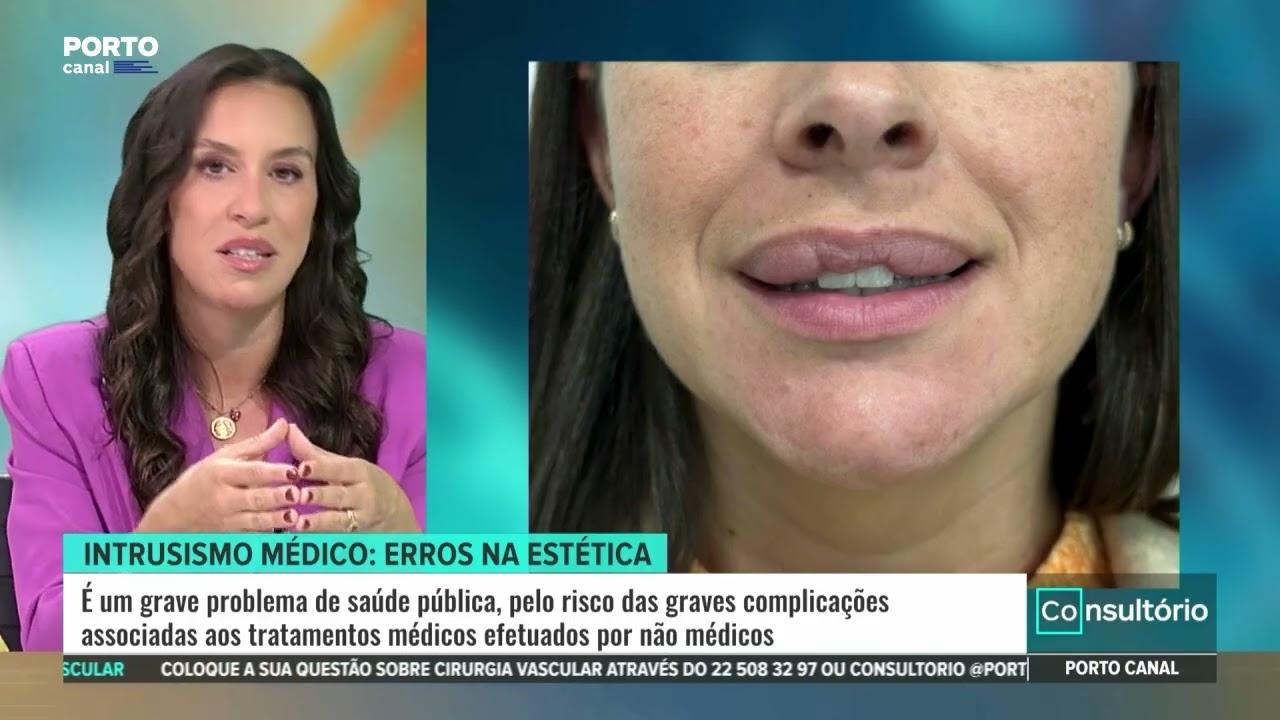 A Importância da Segurança na Medicina Estética: Entrevista com a Dra. Adriana Relvas no Porto Canal