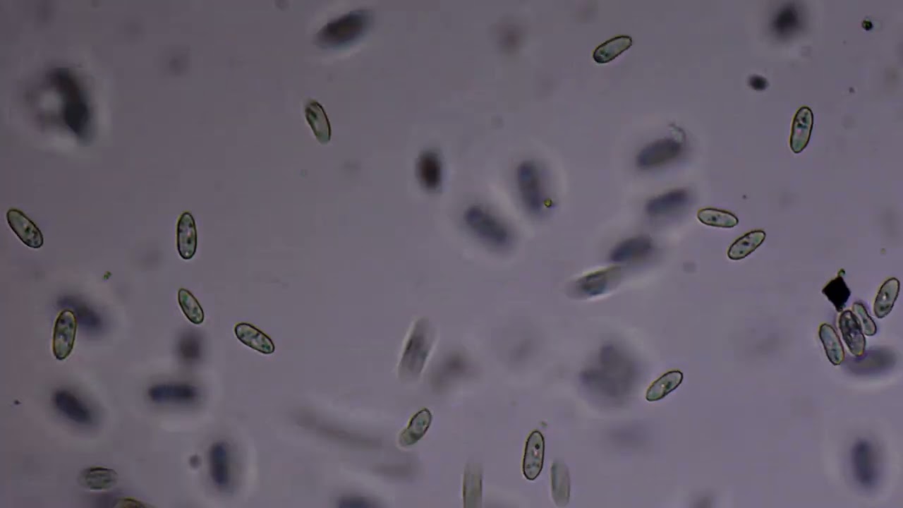 Infestação de Cyclidium - 100x