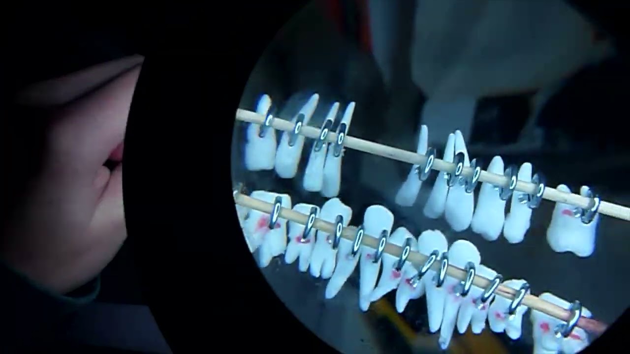 Making A Mount for Human Teeth