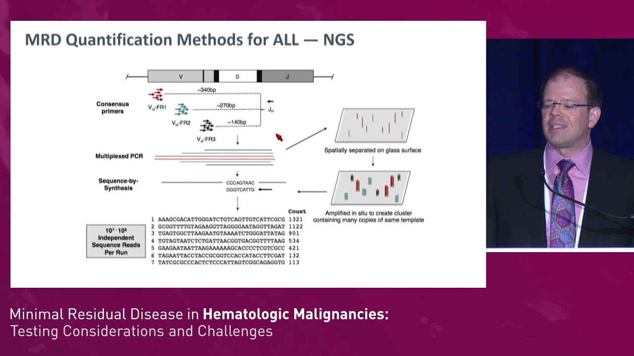 Acute Lymphocytic Leukemia: Overview of Latest Guidelines in Hematological Malignancies