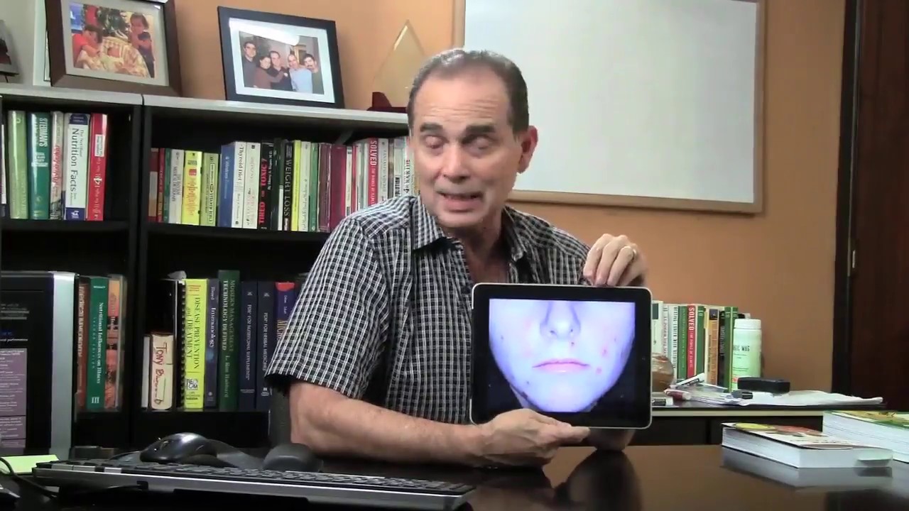 Episodio # 809 El acné, ¿Cual es la causa?