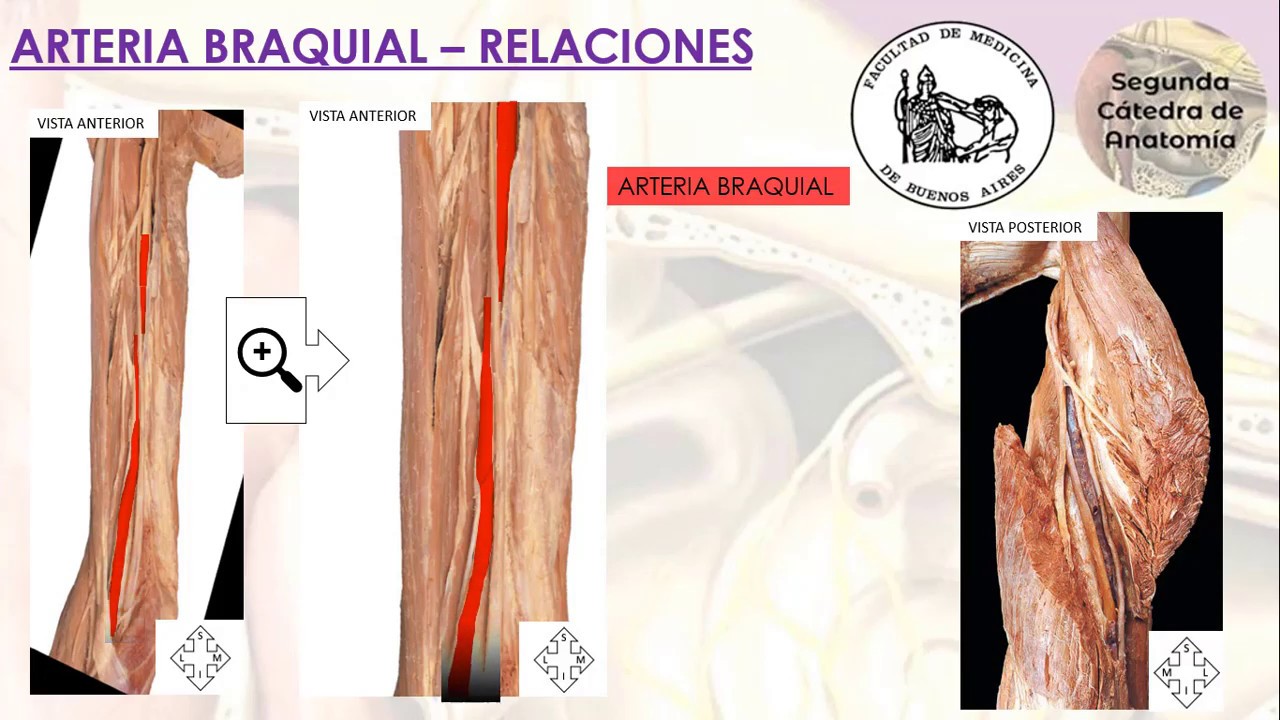 L2.2 | Vascularización del miembro superior | Anatomía 2 | FMed UBA