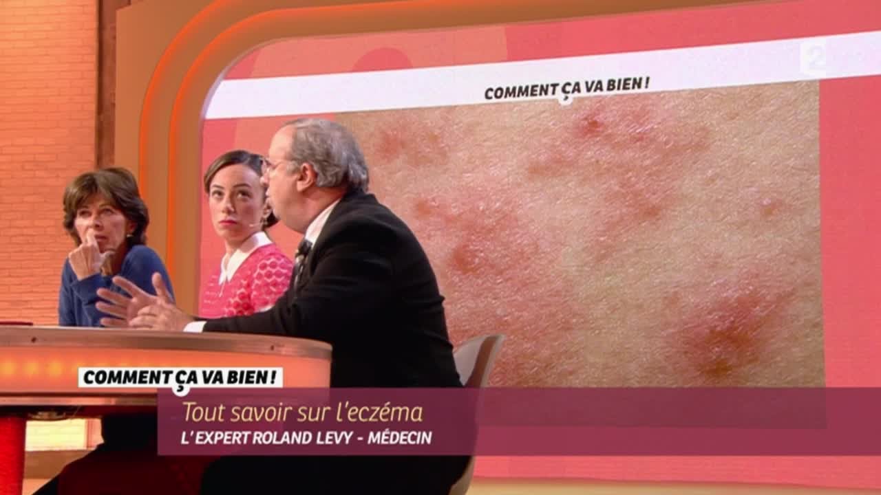 [SANTE] Tout savoir sur l'eczéma #CCVB