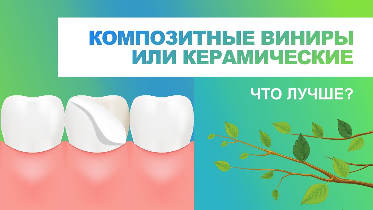 🦷 Композитные виниры или керамические.Что лучше?