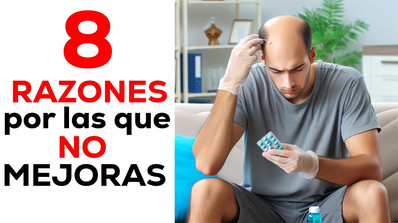 8 RAZONES por las que NO MEJORAS de tu ALOPECIA