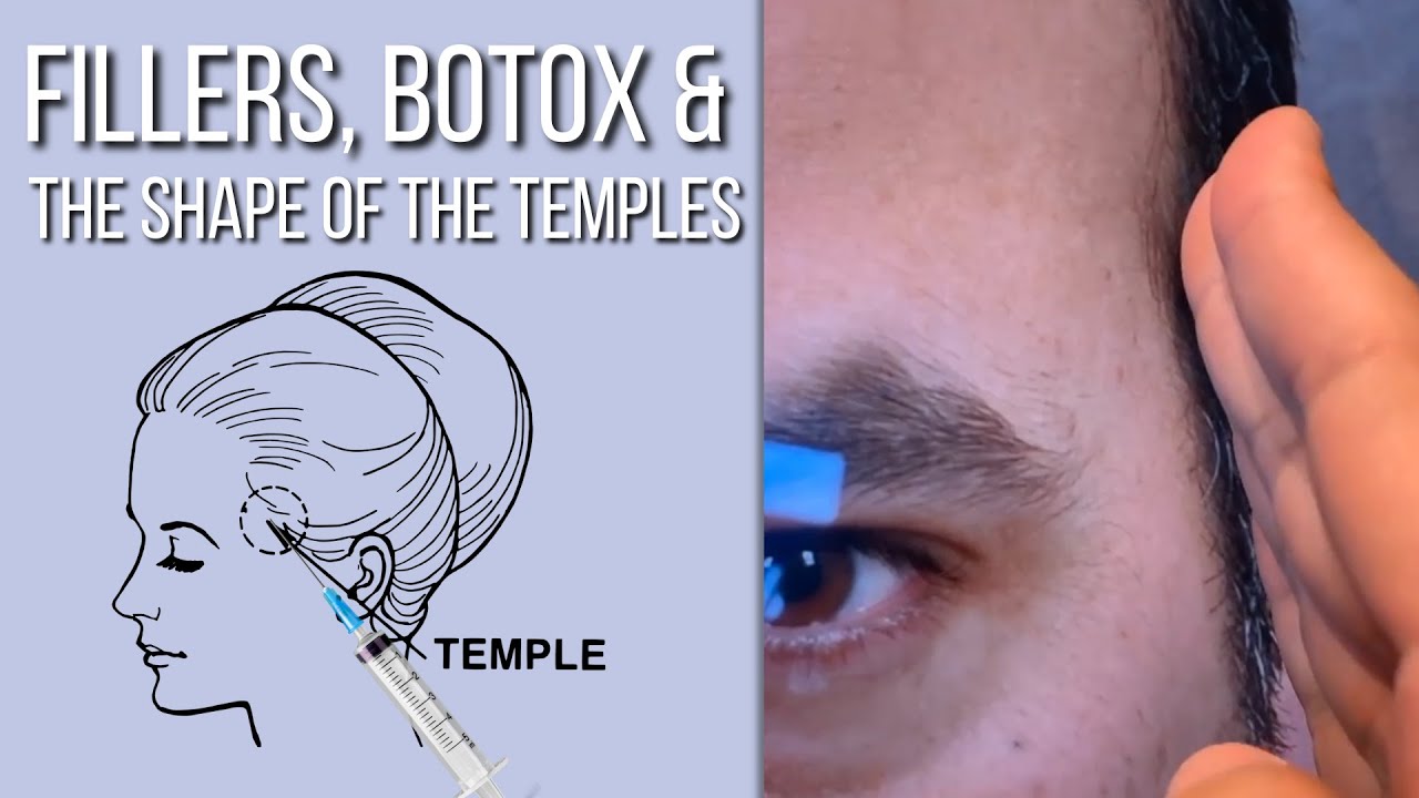 Fillers, Botox & The Shape of The Temples | Dr. Ben Talei | Beverly Hills CA