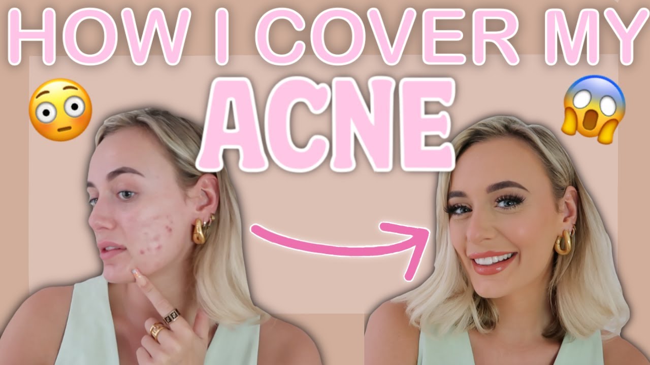 EVERYDAY MAKEUP ROUTINE | HOW I COVER MY ACNE
