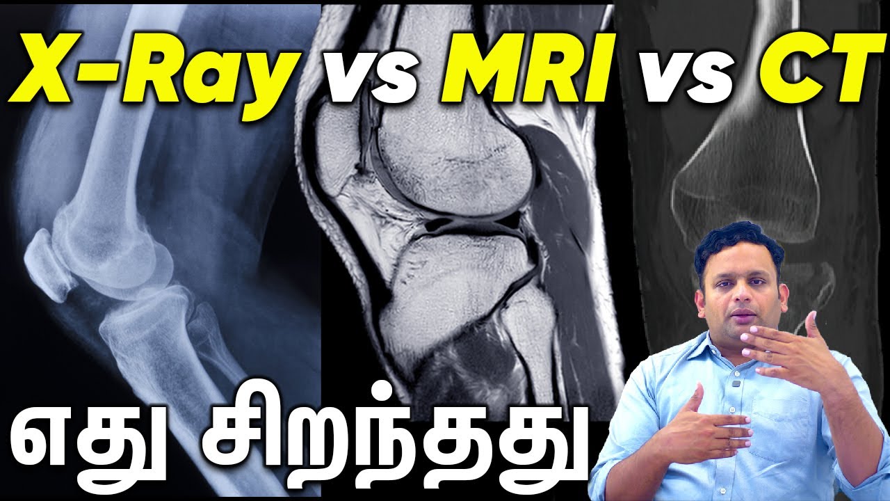 MRI vs CT vs X-Ray - Which is Better? Dr Shriram Krishnamoorthy  Tamil