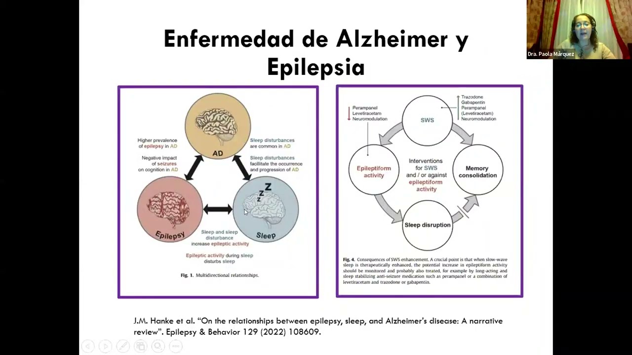 Curso Básico de Epilepsia - Semana 3