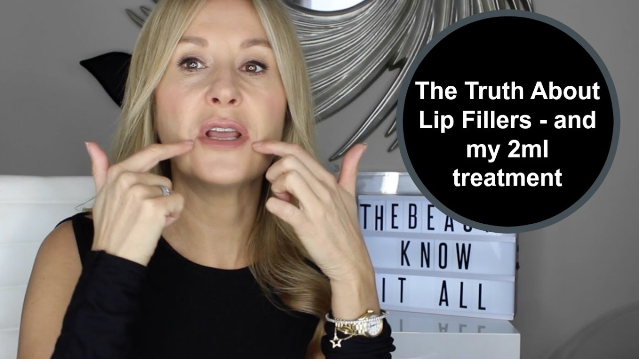 The Truth About Lip Fillers (and my 2ml injections)  - Nadine Baggott