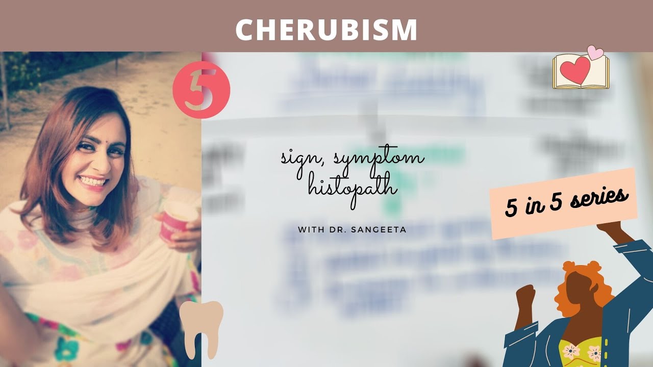 cherubism