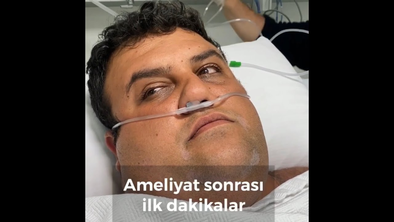 T&uuml;p mide ameliyatı zor mu?