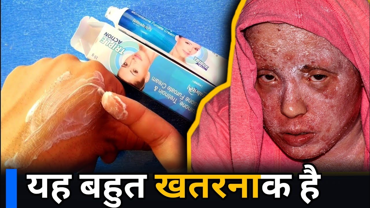 Ultrabrite Skin Cream | Ultrabrite Skin Cream Kaise Use Kare