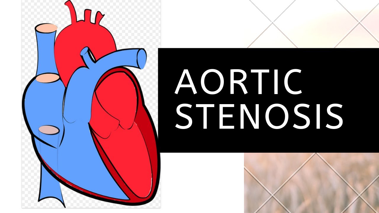 Aortic Stenosis: 5 Quick Info Tips Every Nurse Should Know