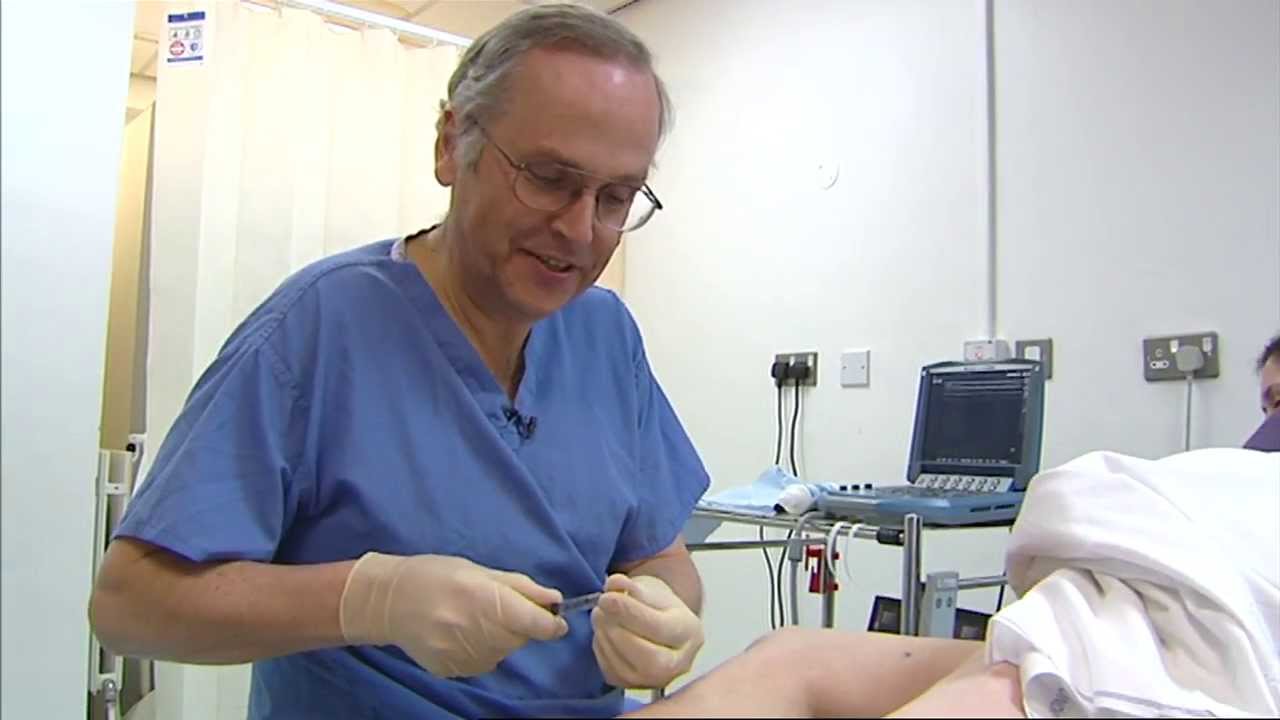 Foam sclerotherapy for varicose veins - a patient's view - Philip Coleridge Smith