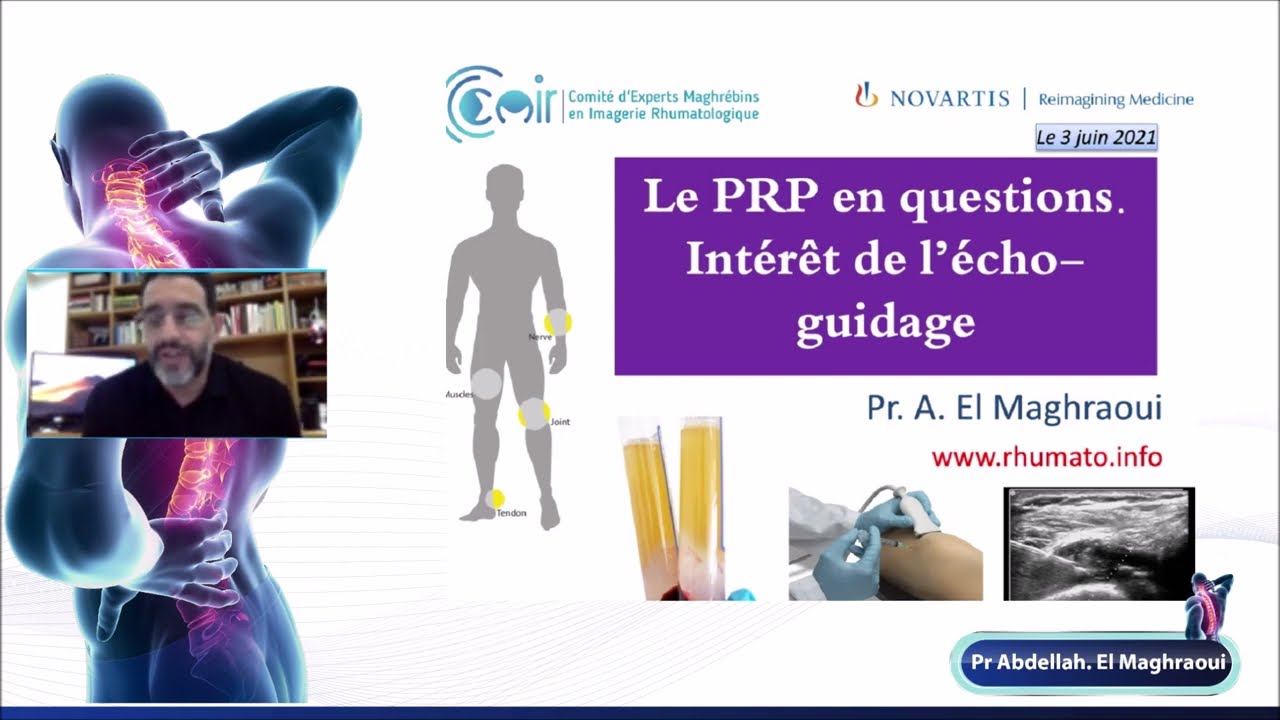 Plasma riche en plaquettes (PRP), intérêt de l'échoguidage, par Abdellah ELMAGHRAOUI