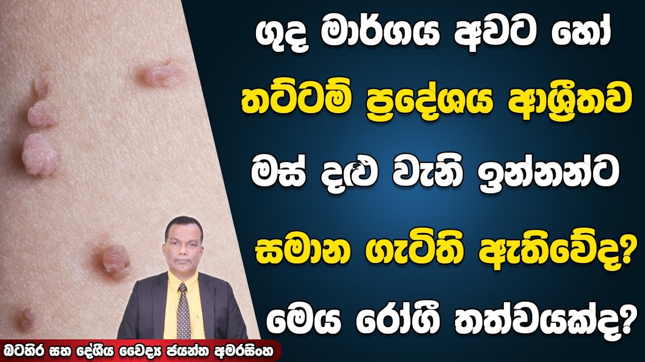 ගුද මාර්ගය අවට හෝ තට්ටම් ප්&zwj;රදේශයේ මස් දළු වැනි ඉන්නන් හා සමාන ගැටිති ඇතිවනවාද? මෙය රෝගී තත්ත්වයක්ද?