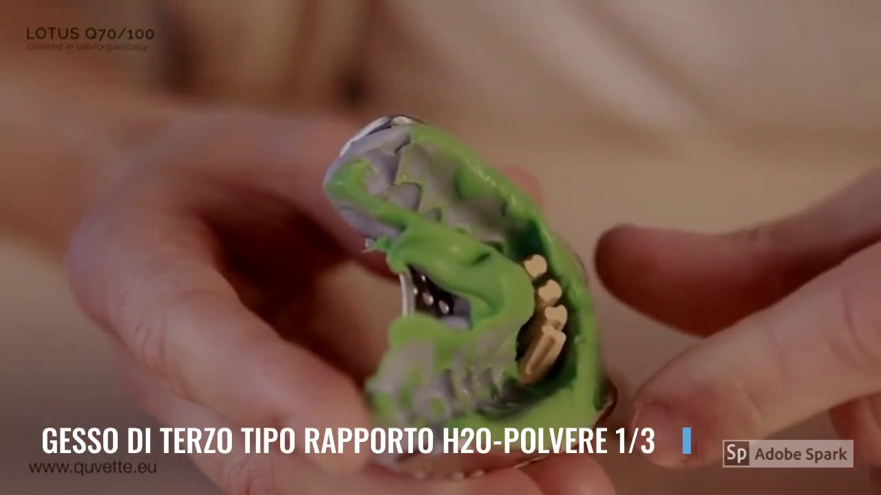 Videolezione modello con monconi carotizzati Prof Ciccone