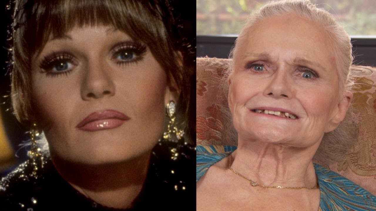 &lsquo;Superman&rsquo; Star Valerie Perrine Gets New Teeth After Suffering From Parkinson&rsquo;s