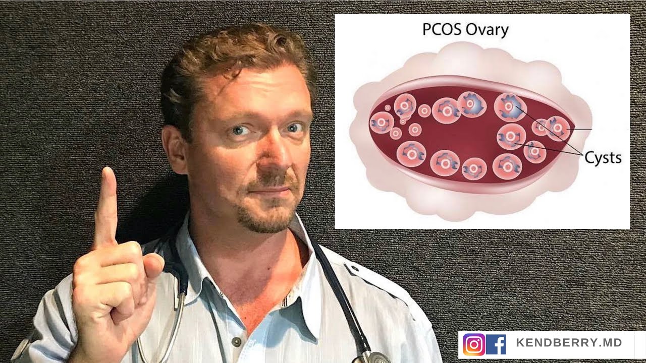 PCOS: Could it be Your DIET? (Fertility Update 2026)