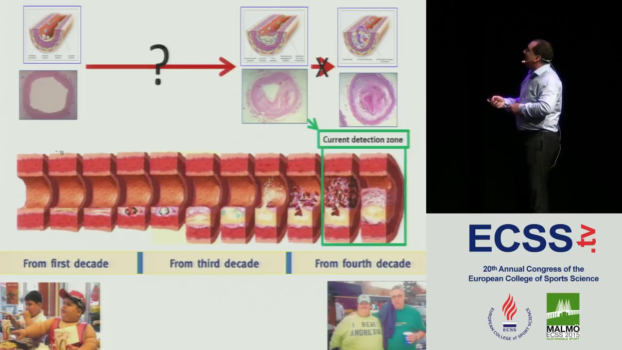 Physical Activity and Cardiovascular Disease in Young People: Can CVD be Prevented.. - Prof. Green