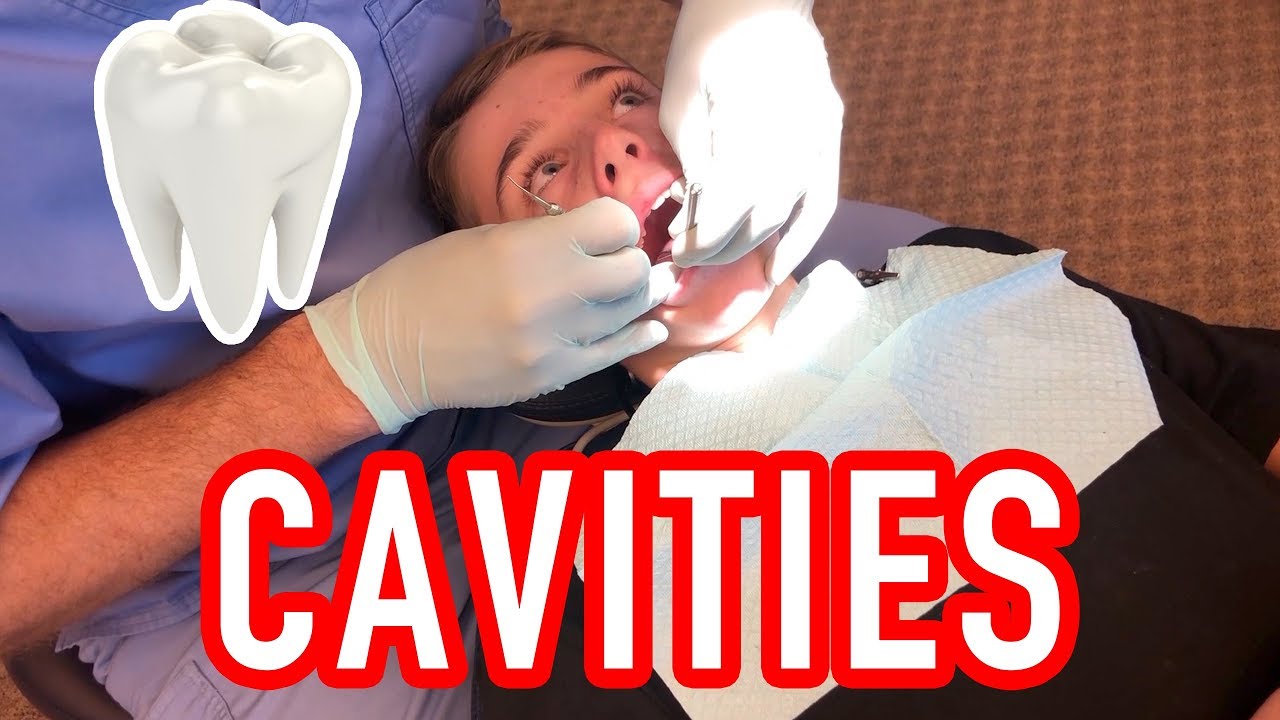 🤭Cavities
