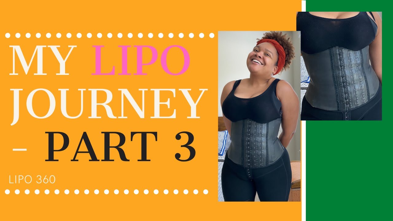 My Liposuction Journey - Lipo 360 - Part 3 - How much was it?