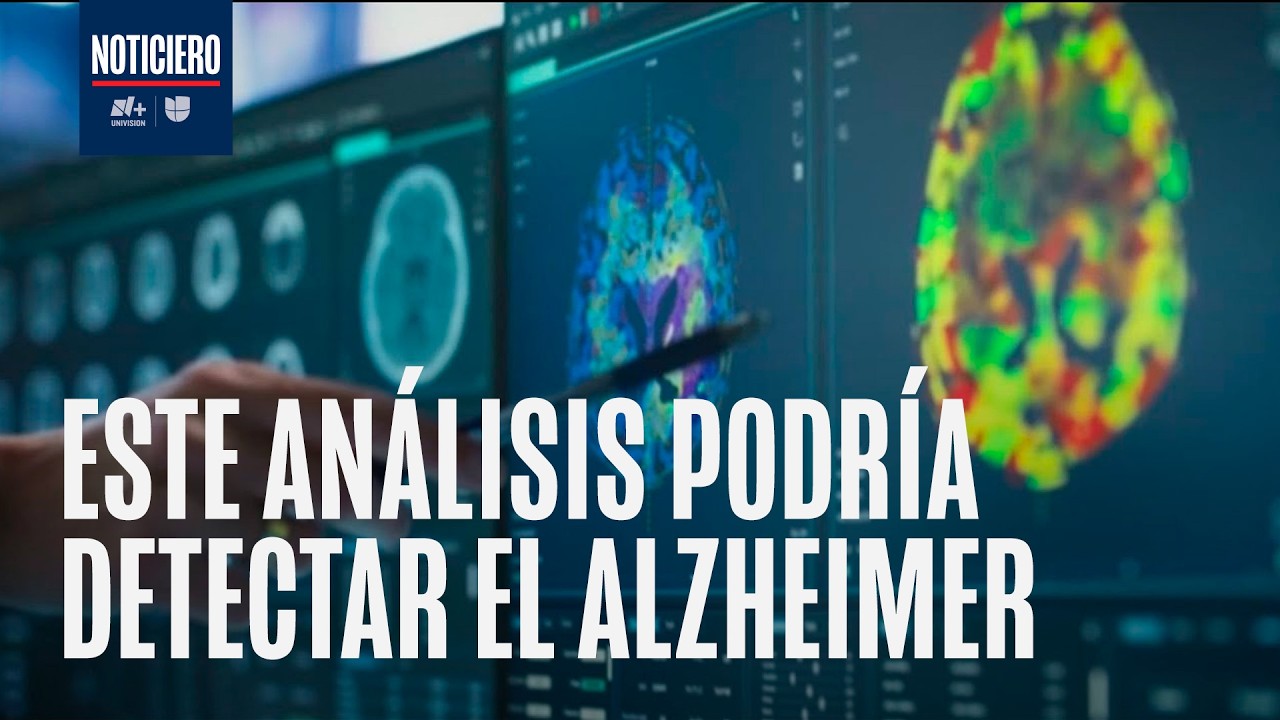 ¿Alzheimer de mujeres puede detectarse a tiempo? Neurólogo explica este nuevo estudio