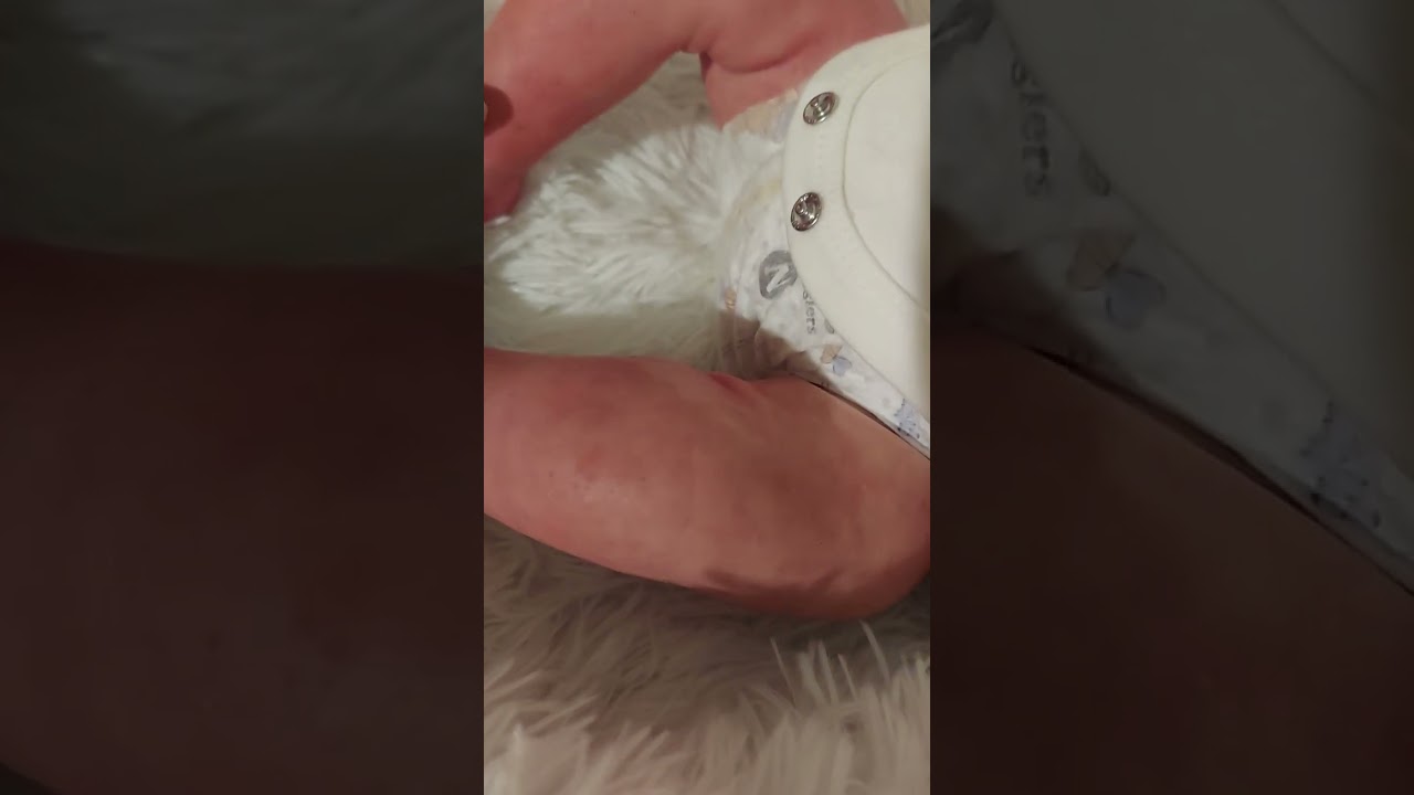 Partial Silicone baby 
